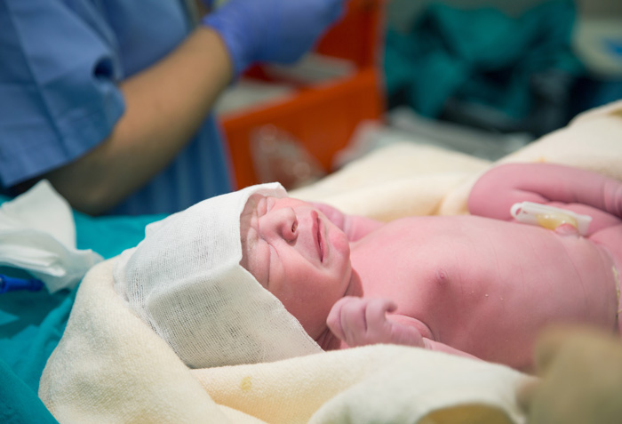 C-Section Recovery All You Need To Know - NeuroticMommy